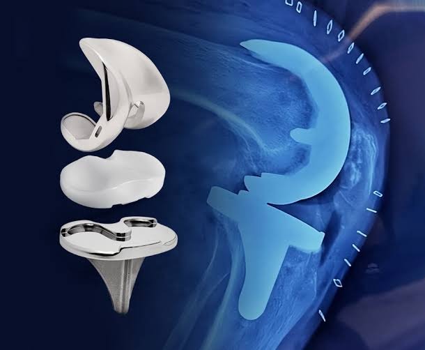 Prótesis de Rodilla
